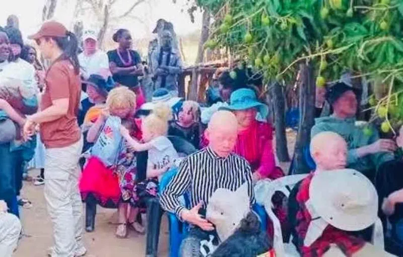 Pessoas com albinos da Cahama contemplados com produtos dermatológicos