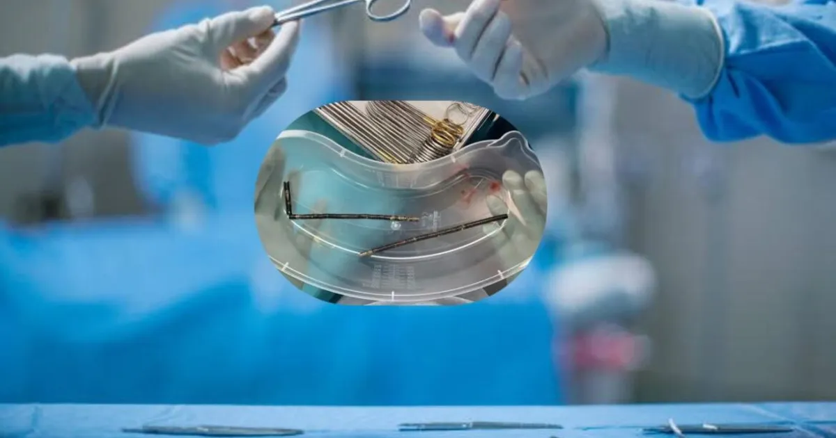Adolescente submetido a cirurgia após engolir cerca de 100 ímanes que comprou na internet