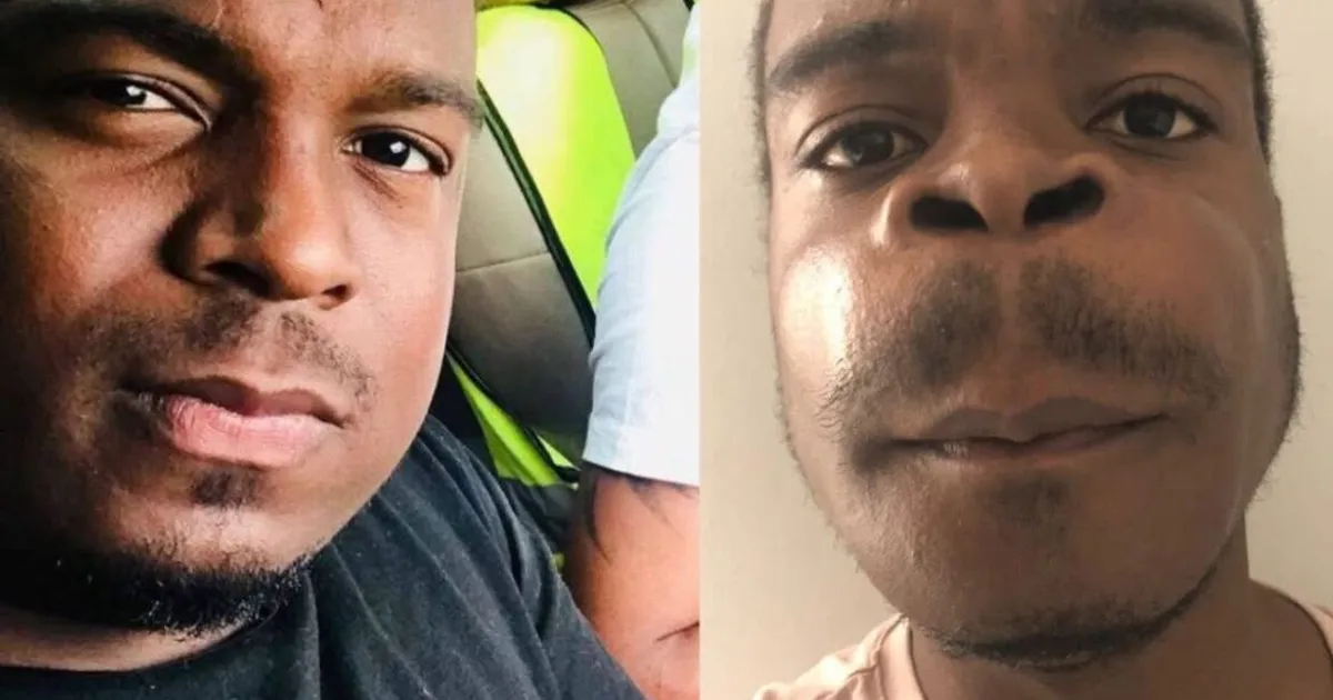 Jovem que luta contra um tumor grave: “Só estou a pedir uma oportunidade para viver”