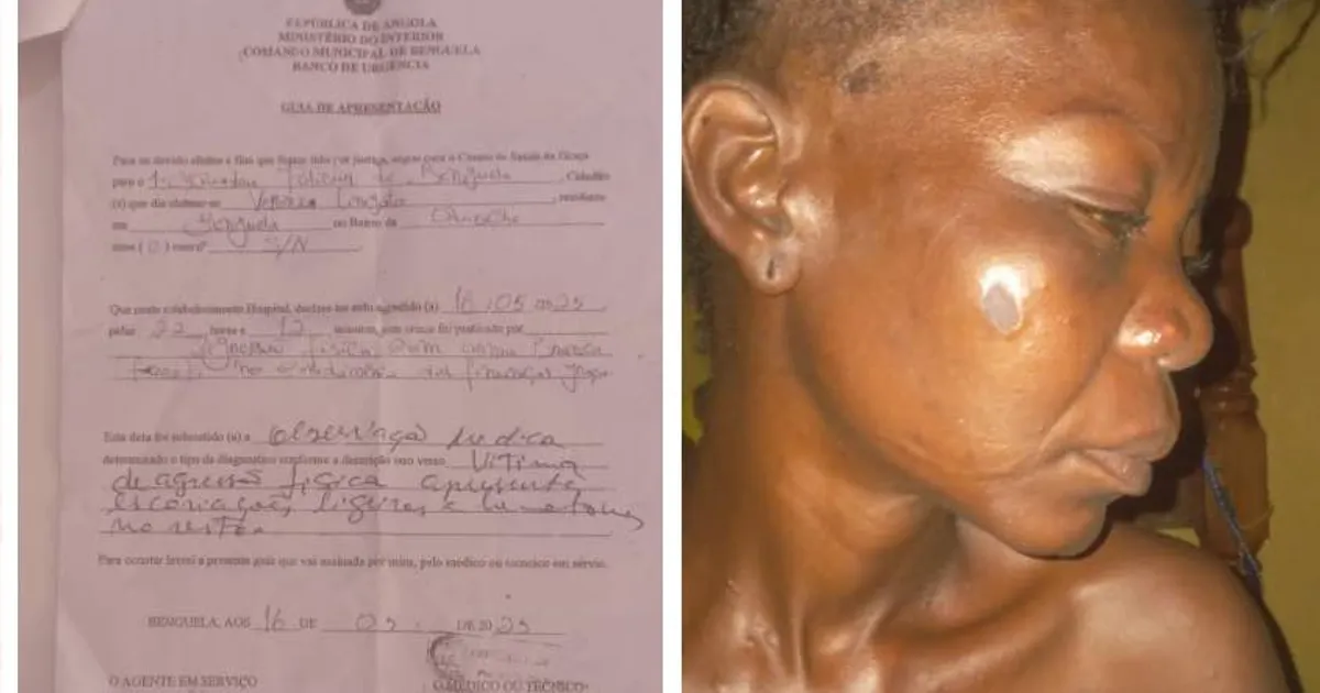 Mulher diz-se agredida por antigo deputado da UNITA  com quem maninha relação  amorosa