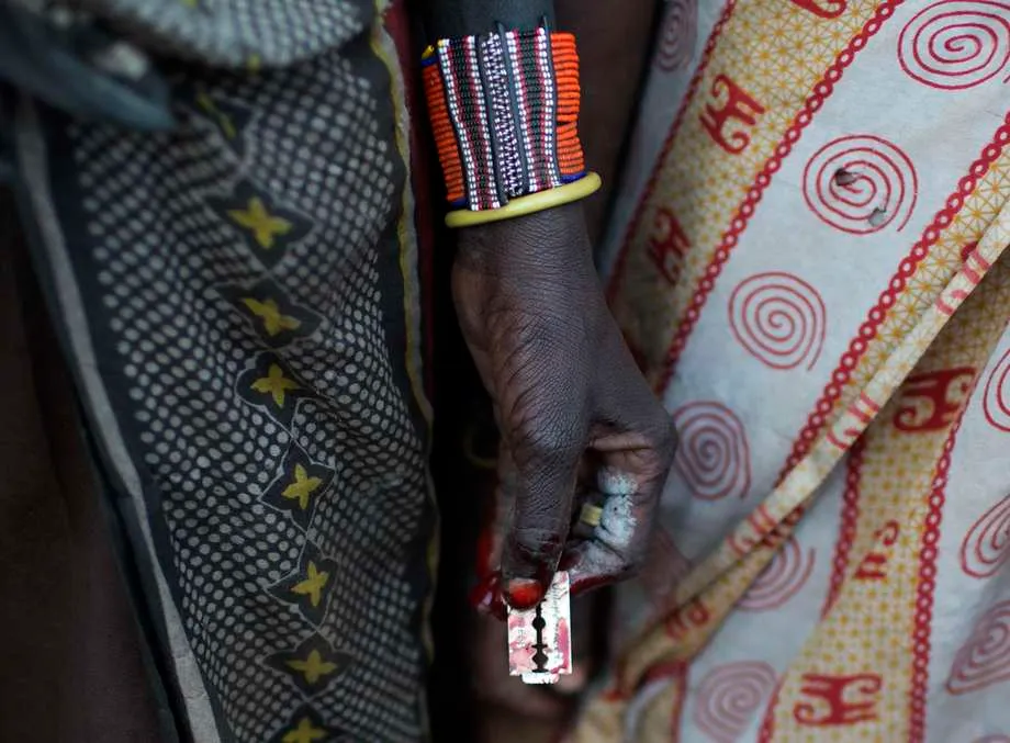 Pelo menos 50% das meninas e mulheres foram submetidas à mutilação genital na Guiné-Bissau
