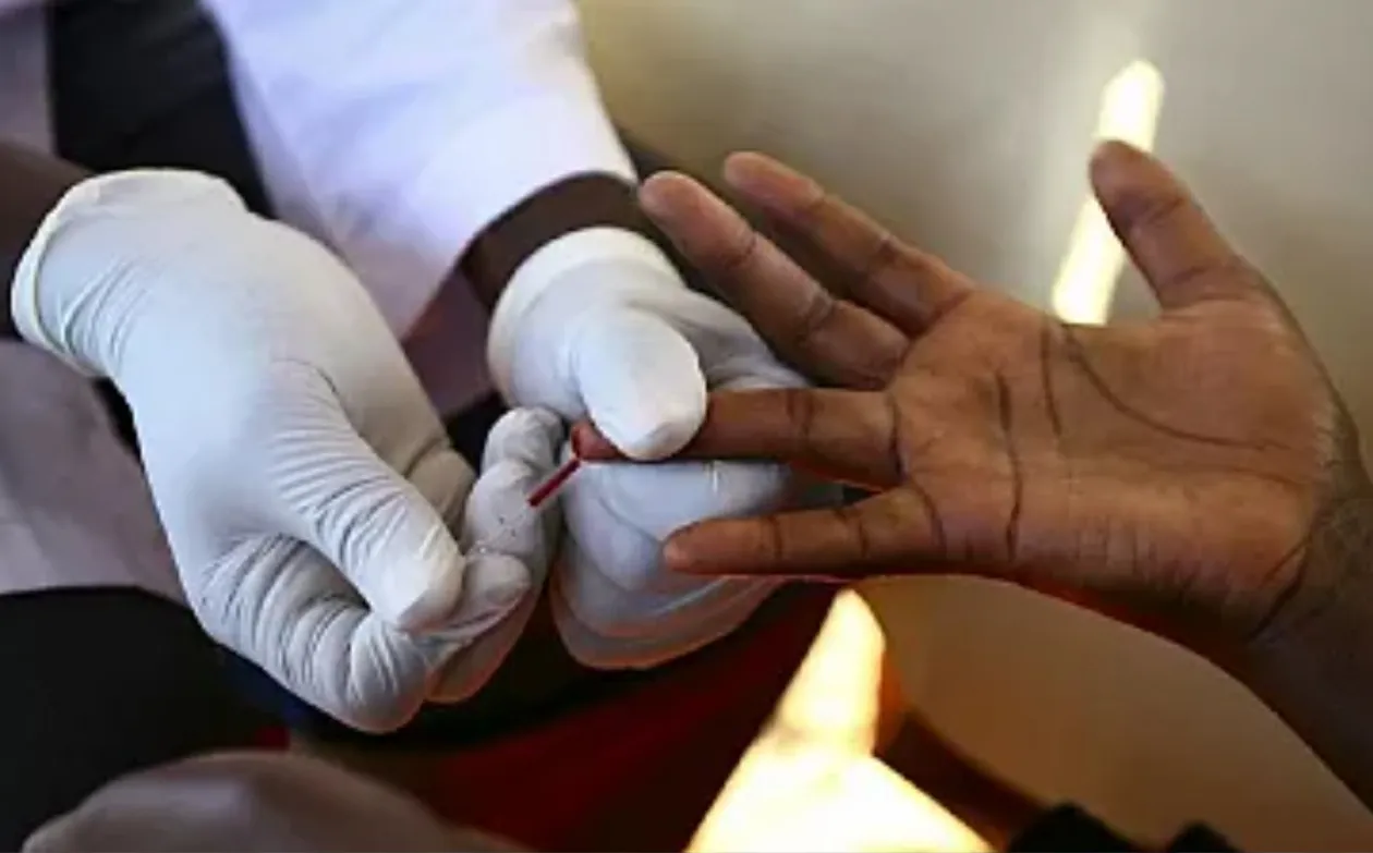 Huambo regista mais casos e mais mortes por VIH/SIDA