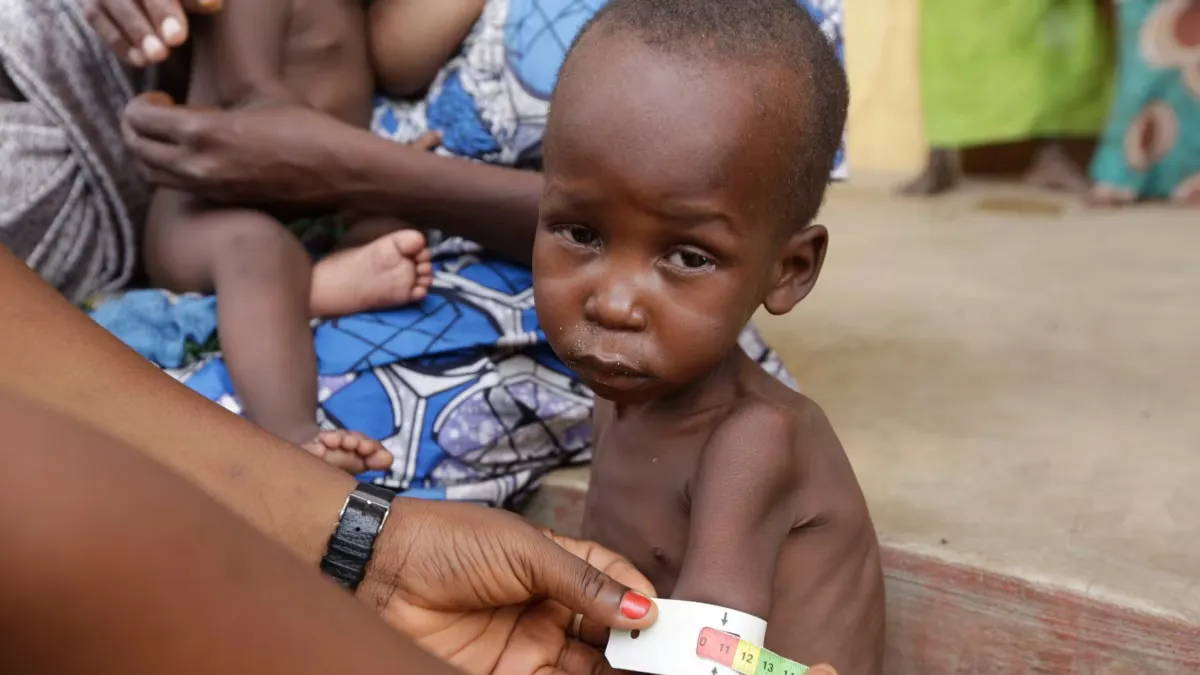 Desnutrição infantil faz 11 mortes no Uíge