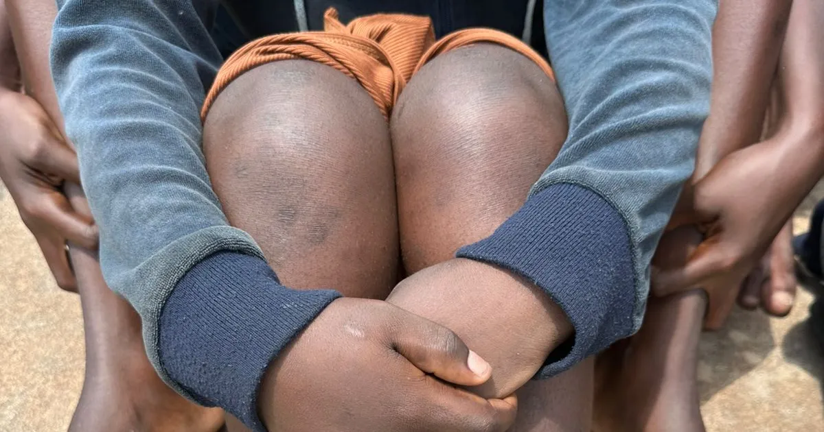 Cidadã mutila órgãos genitais do marido por negar dar dinheiro para compra do leite da filha