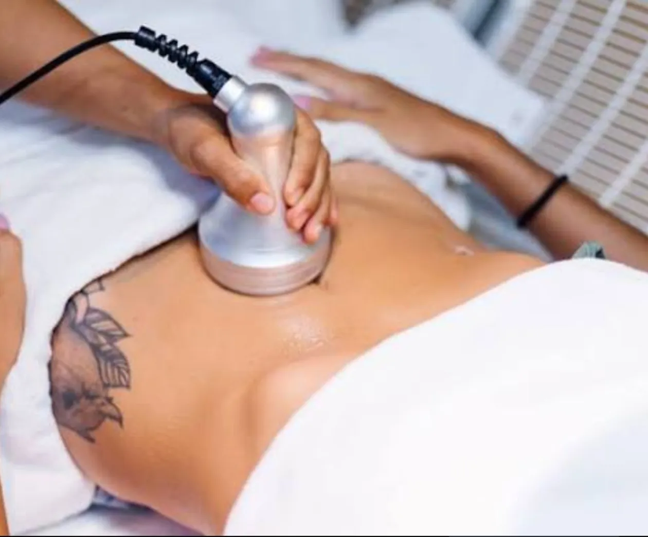 Cidadã morre após procedimento estético e SIC detém duas esteticistas