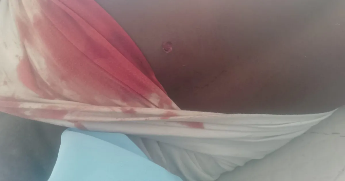 Marginal morto a tiro por efectivo da Polícia Nacional em Quipungo