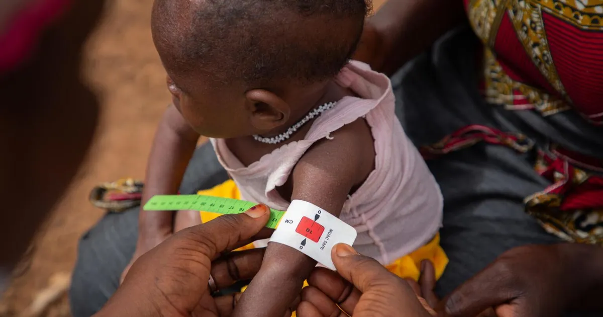 Cubango: morte de crianças por desnutrição preocupa governo