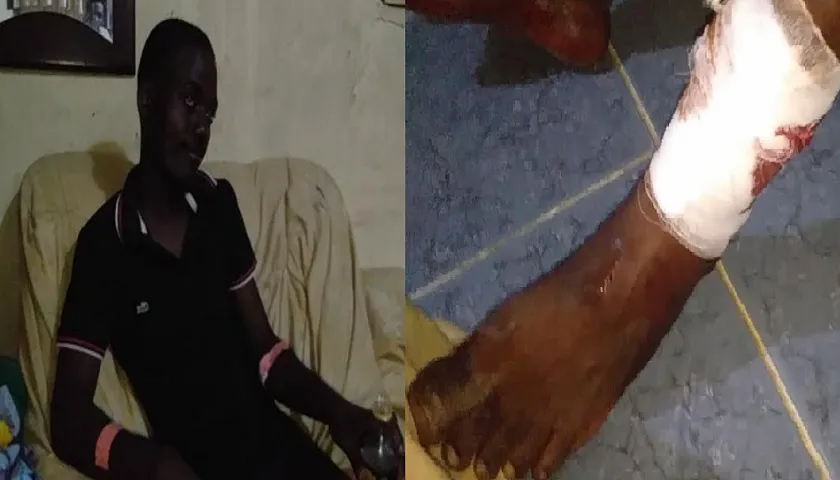 Jovem Baleado Ao Evitar O Roubo Da Sua Motorizada