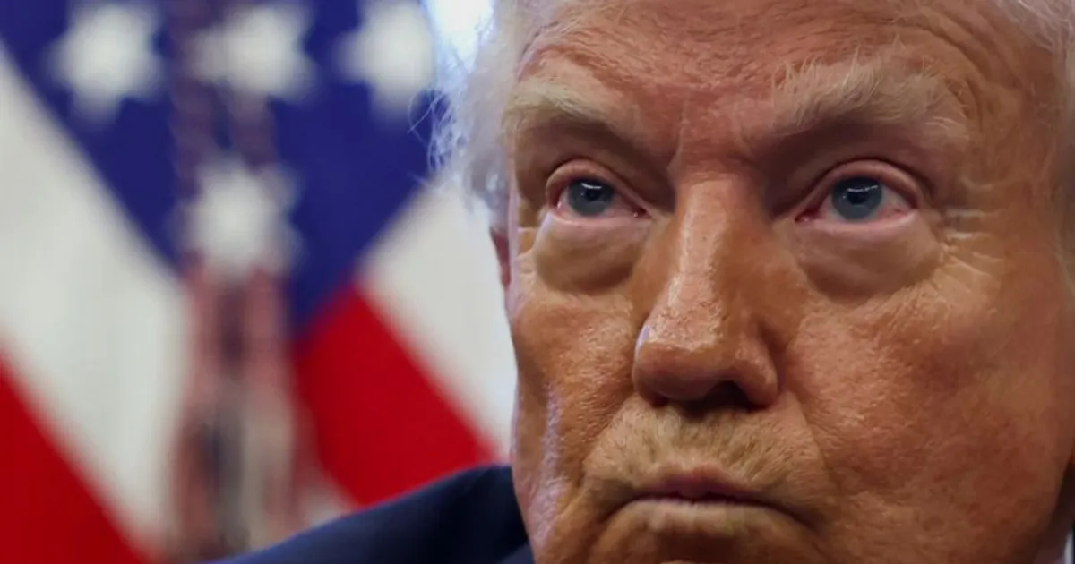 Donald Trump diagnosticado com insuficiência venosa crónica
