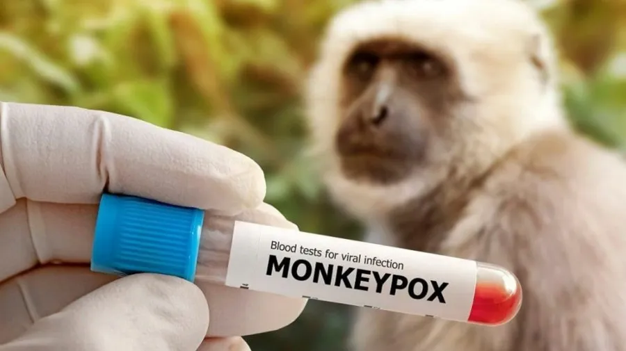 Cabinda regista nove novos casos positivos da varíola dos macacos
