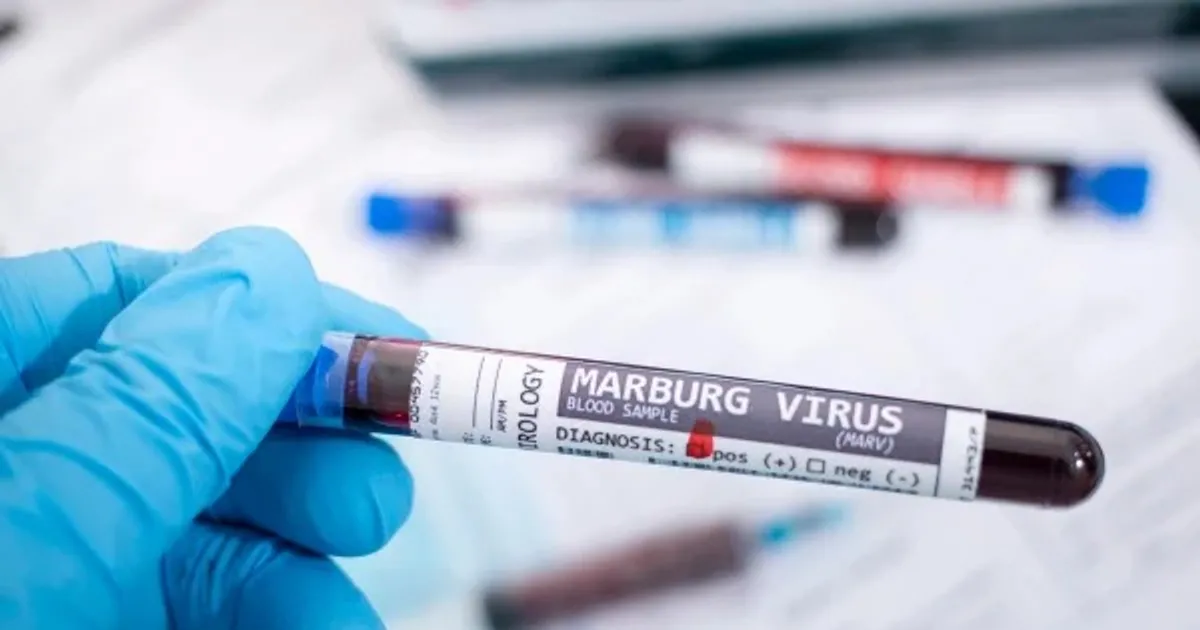 Etiópia regista três mortos devido a novo surto do vírus Marburgo