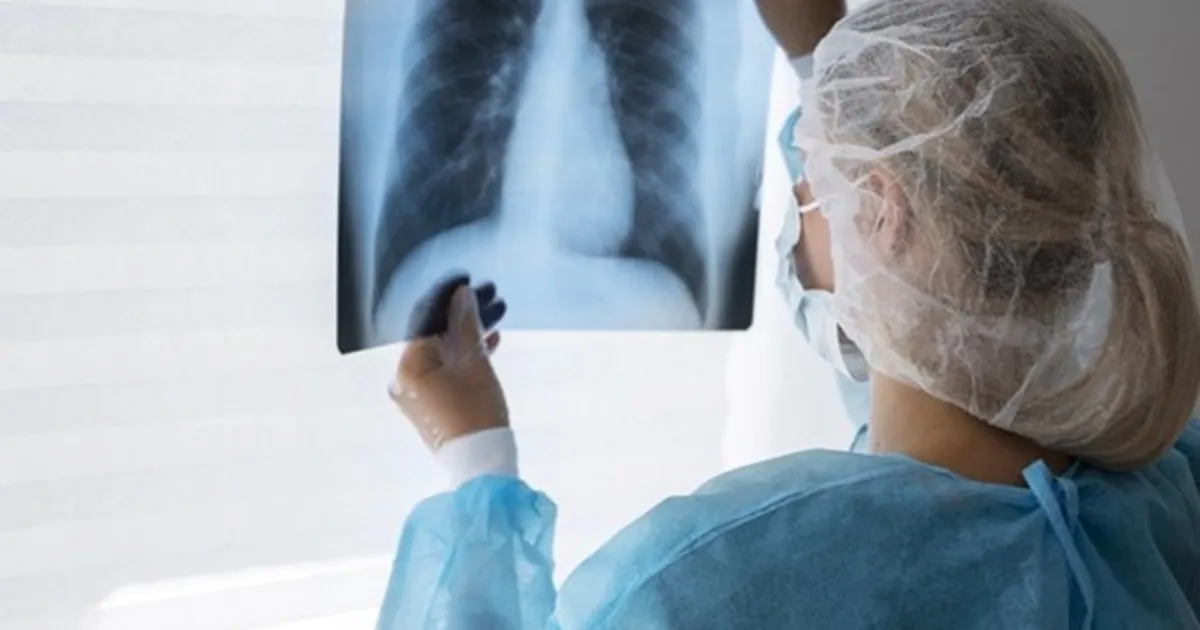 Tuberculose mata 71 pessoas na província de Nampula em seis meses