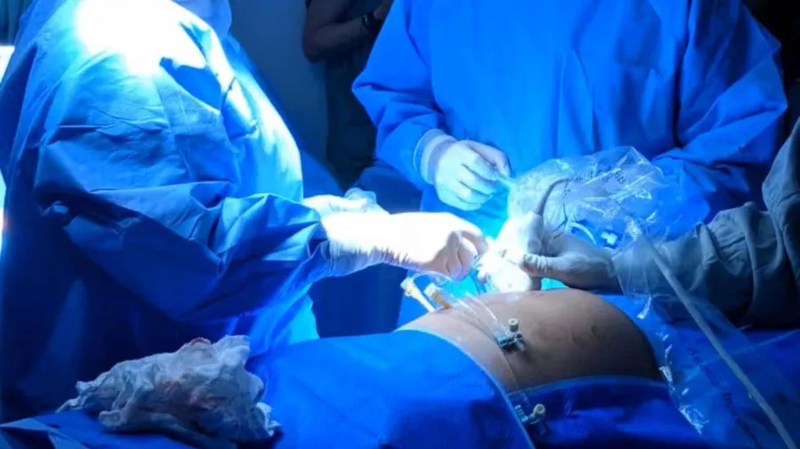 Médicos realizam cirurgia em feto com intestinos fora do corpo