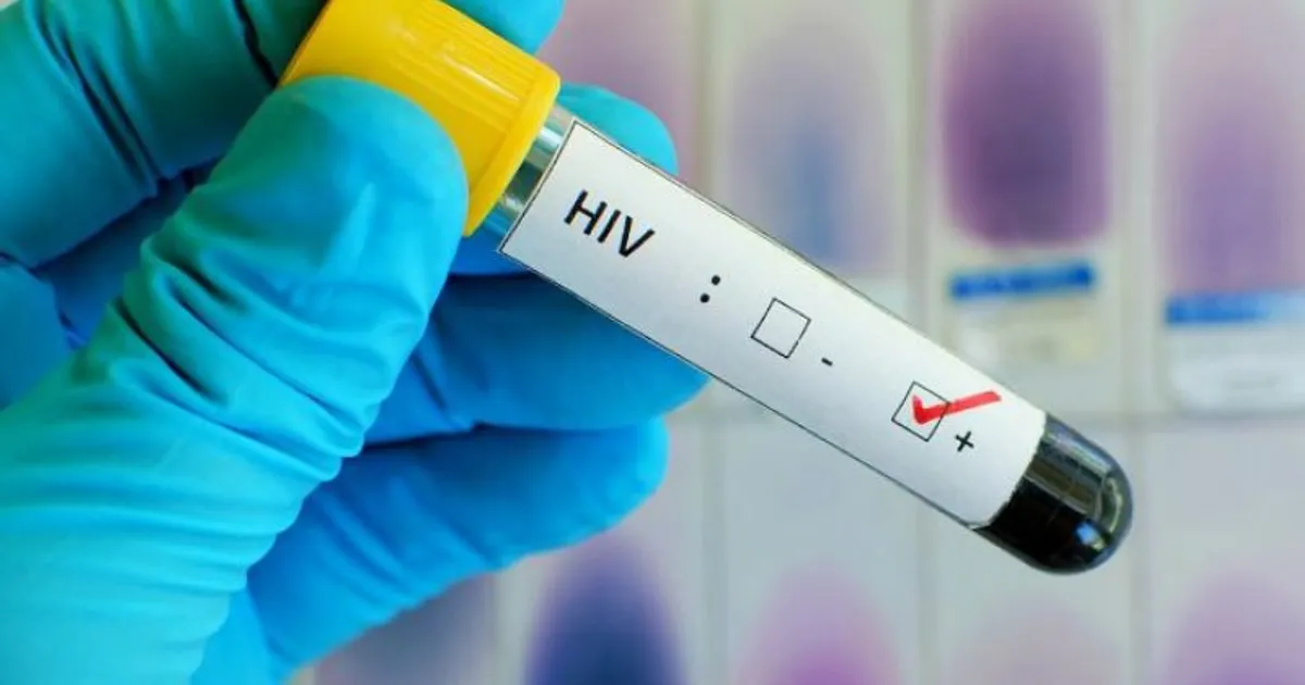 VIH/SIDA mata 13 mil pessoas e infecta mais de 25 mil anualmente em Angola, revela ANASO