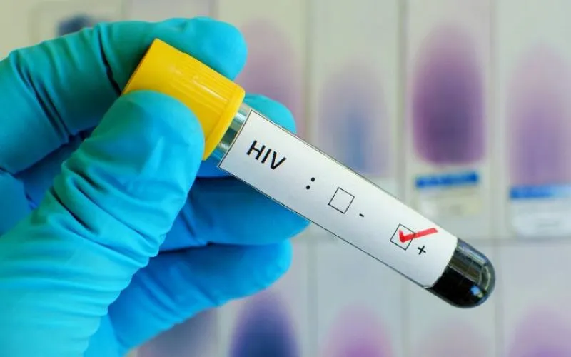 País regista média diária de mais de 50 novos casos de VIH/SIDA e metade dos infectados não está em tratamento