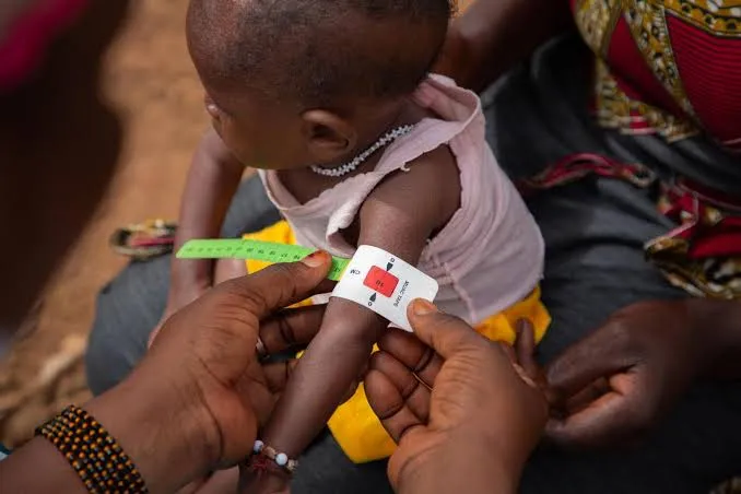 Luanda regista mais de 10 mil casos de desnutrição infantil