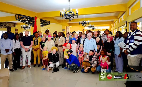 Cabiri acolhe encontro provincial com pessoas com albinismo