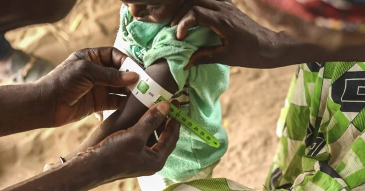 PAM alerta para "aumento histórico" de desnutrição crónica em Angola