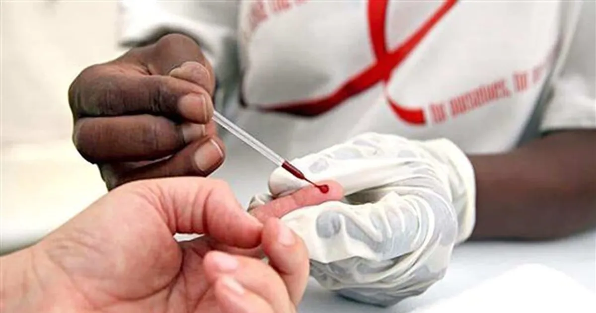 Sida: 57 novos casos/dia e mais de metade dos pacientes sem tratamento
