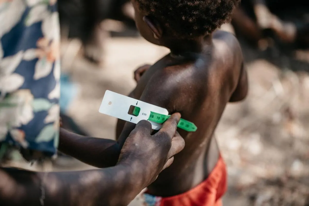 Desnutrição infantil provoca 11 mortos em Maquela do Zombo