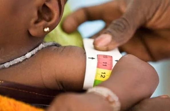 Inquérito SMART: Ministério da Saúde e UNICEF avaliam situação nutricional das crianças em Angola