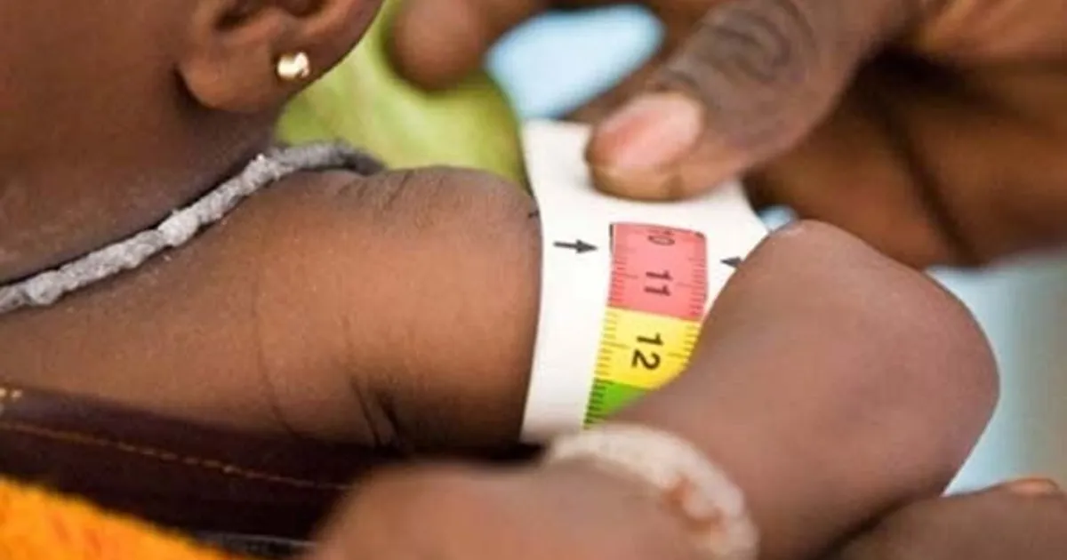 No Huambo, 476 crianças morreram este ano por desnutrição, o que representa um aumento de 190 óbitos em relação ao ano passado - Falta de aleitamento materno entre as principais causas