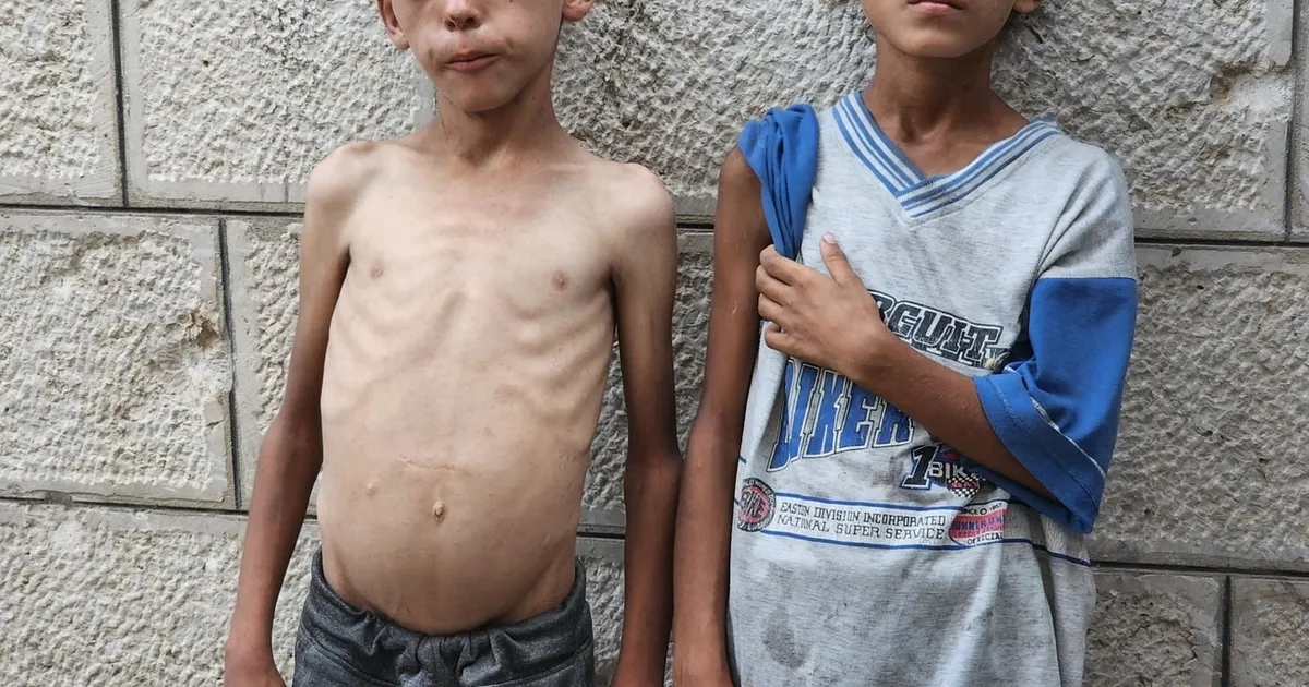 Médio Oriente: O mundo começa a despertar para o genocídio em Gaza, mas é tarde demais para milhares de crianças – Media internacionais acordam para o horror na Palestina