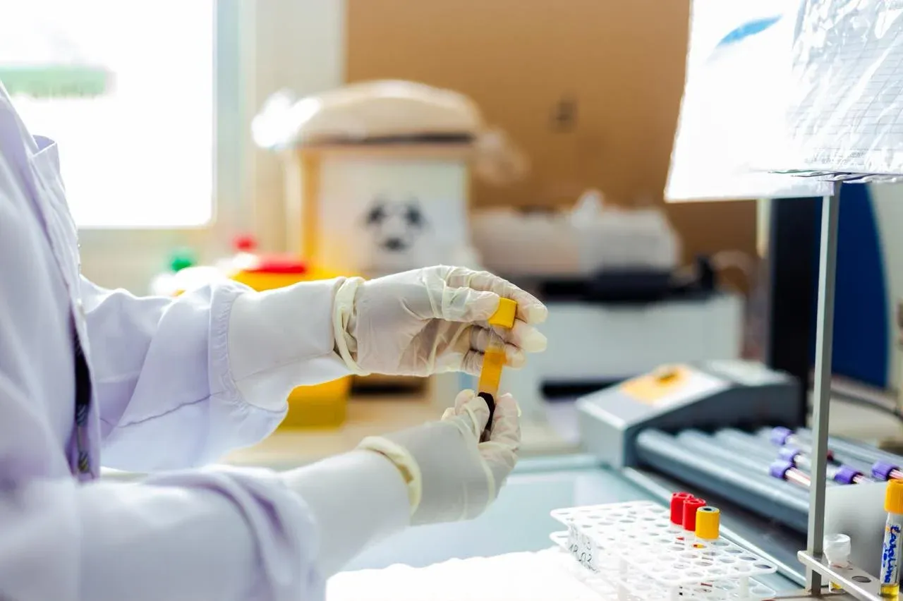 Angola reforça capacidade de diagnóstico e vigilância da Mpox