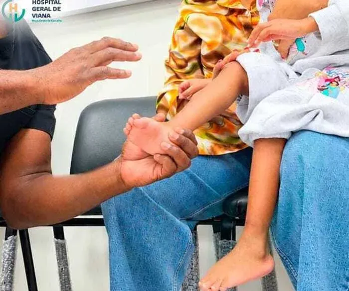 Hospital Emílio de Carvalho realiza campanha de cirurgia do pé e tornozelo